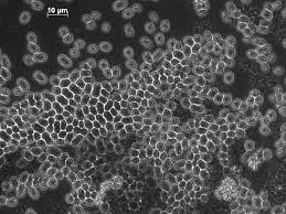 PHA extraction plant in Emmen